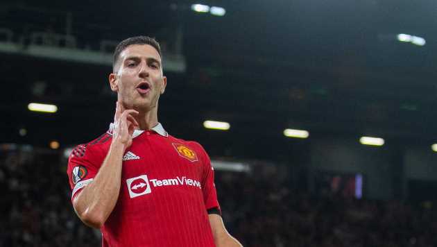 Diogo Dalot gây chú ý với video triệt lông