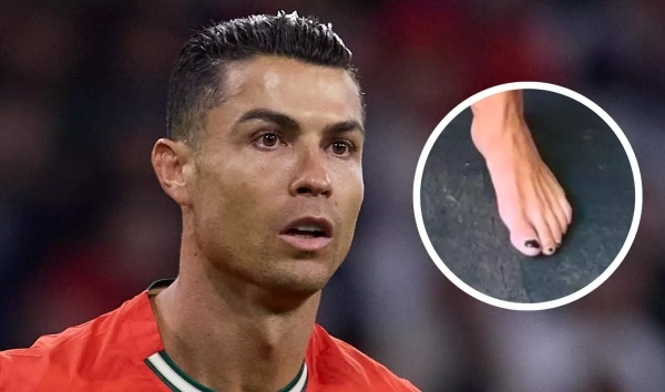 Chiến lược khôn ngoan! Lý do Ronaldo sơn móng chân màu đen